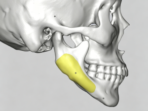 Ceramic 3D Printing Revolutionary Breakthrough in the Medical Field