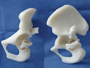 Ceramic 3D Printing Revolutionary Breakthrough in the Medical Field