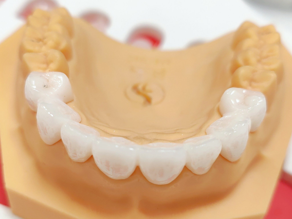 Ceramic 3D Printing in Dentistry Revolutionizing Tooth Restoration