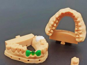 When 3D Printing Meets Healthcare How Photopolymer Resin is Changing the Way We Receive Medical Care