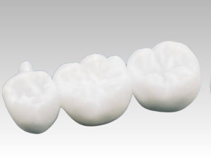 3D-Printed Dental Crowns